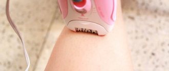 how to choose the right epilator